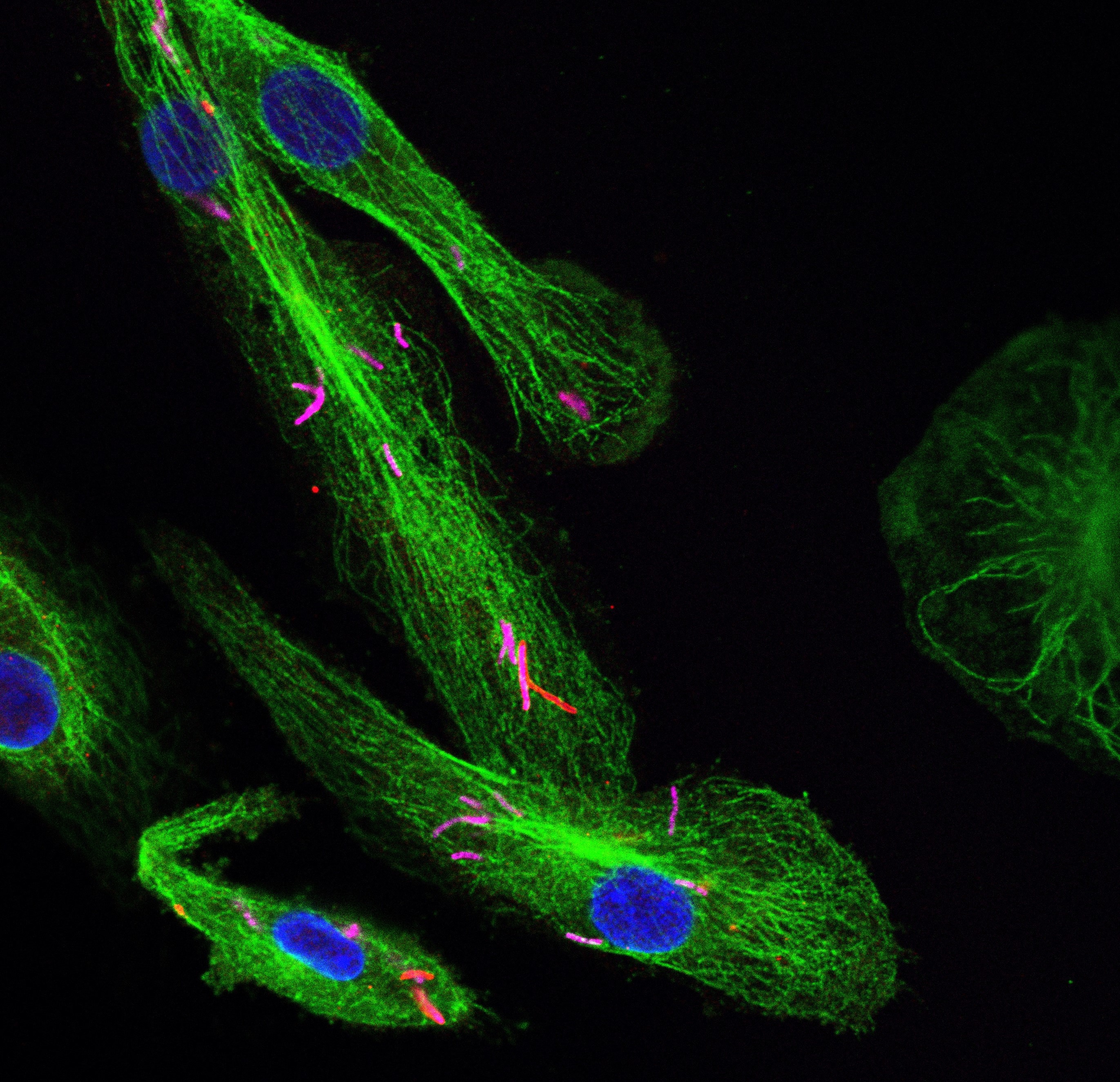 gene therapy placeholder