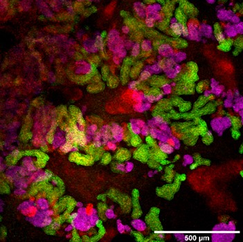 kidney organoid