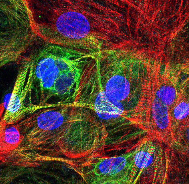 cardiomyocyte